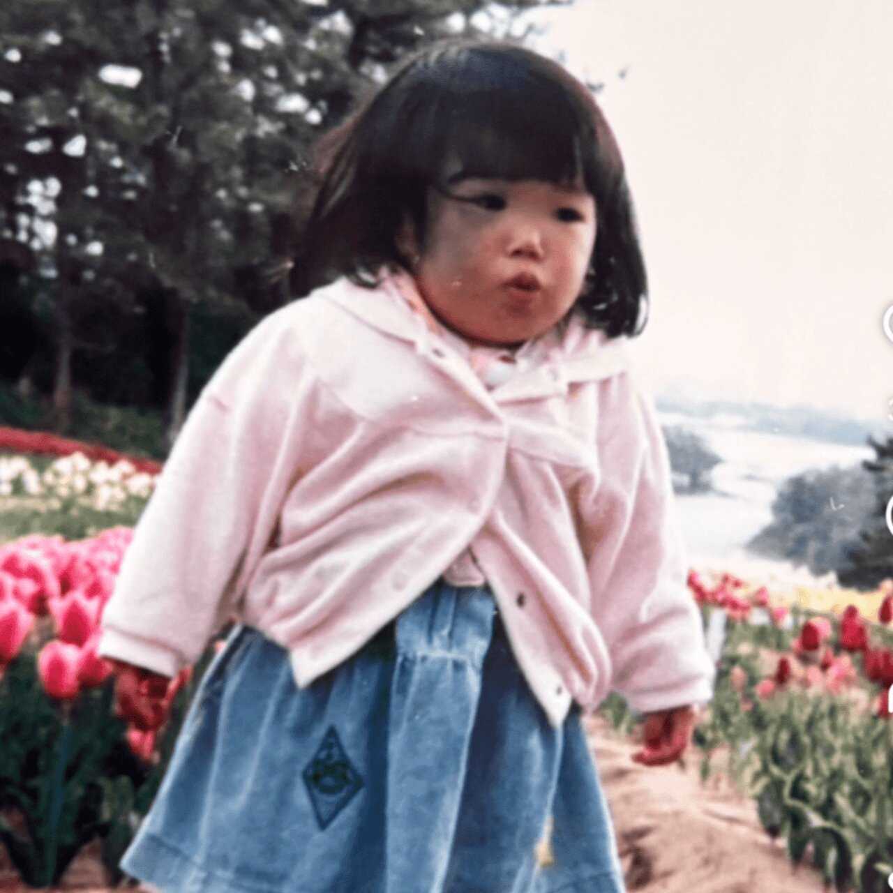 顔の右半分に「生まれつきの青あざ」→外に出るたび「かわいそう」「治療したら？」人と会うのがストレスに…あざと生きる女性を苦しめた「思春期の憂鬱」（文春オンライン）