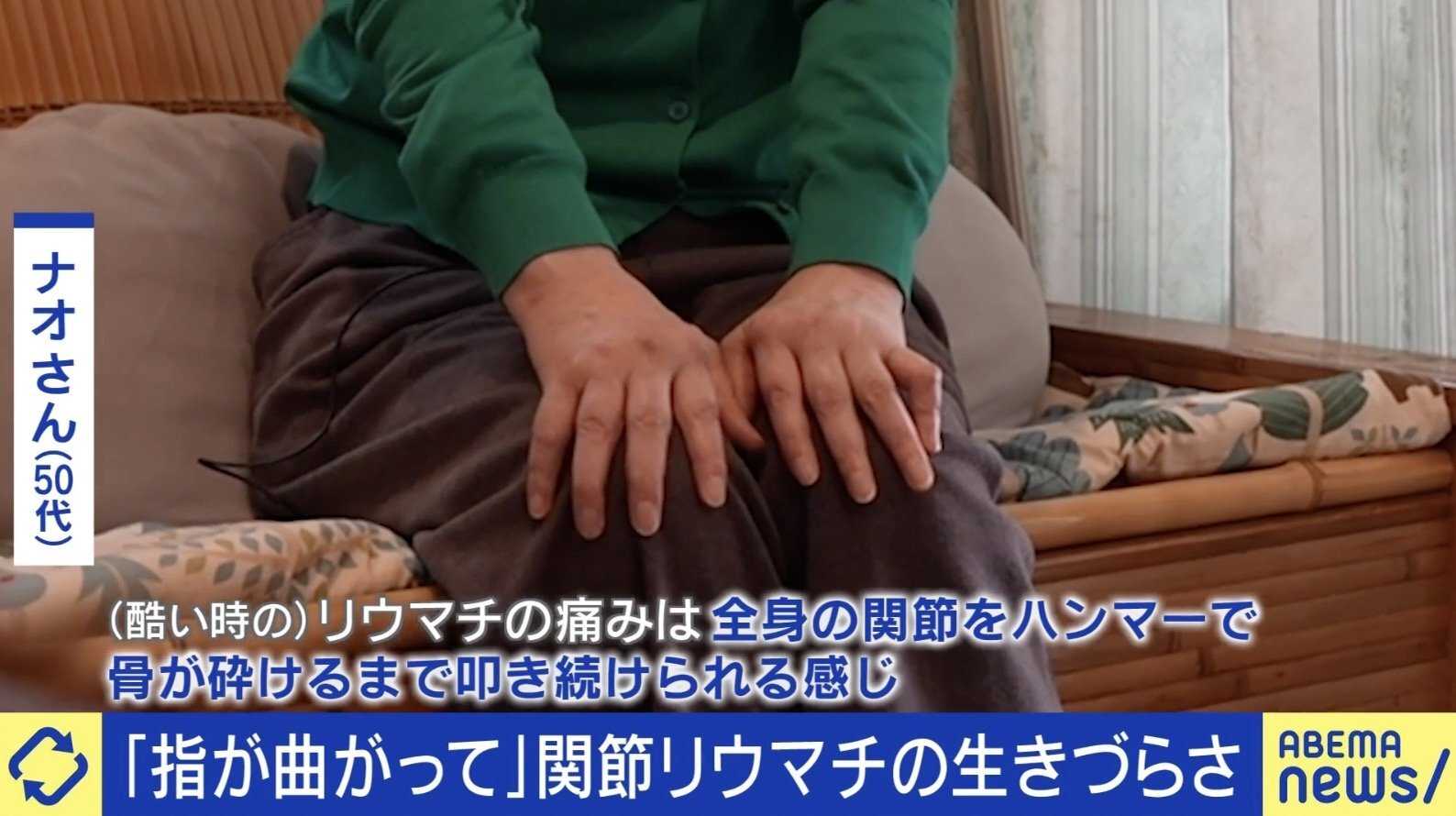 「電動ドリルでガリガリされる感覚」「関節を雑巾絞り」高市総理も苦しんだ関節リウマチ 当事語る生きづらさ（ABEMA TIMES）